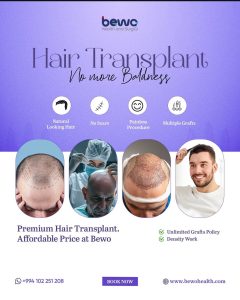 Hair transplant in Baku