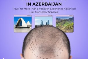 fue-hair-transplant-baku-clinic.jpg