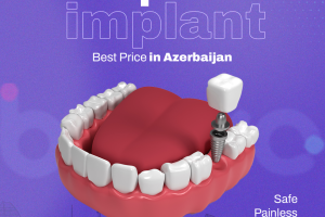 implant 2